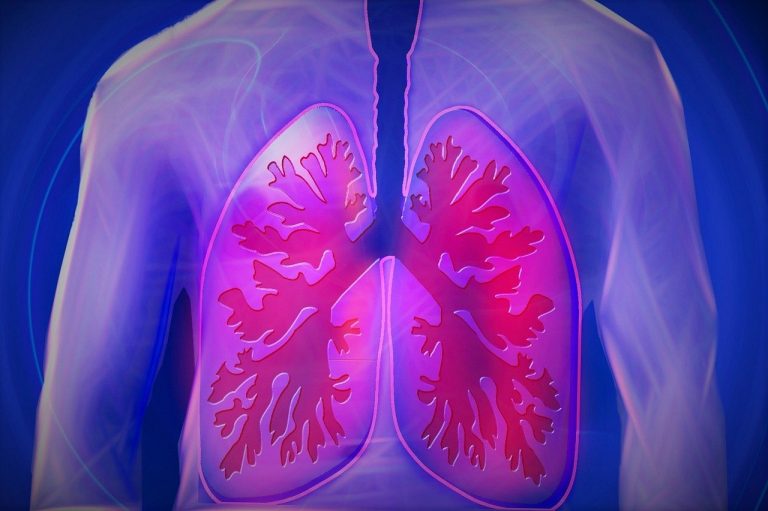 Bronquitis, bronquiolitis e infecciones pulmonares en MTC