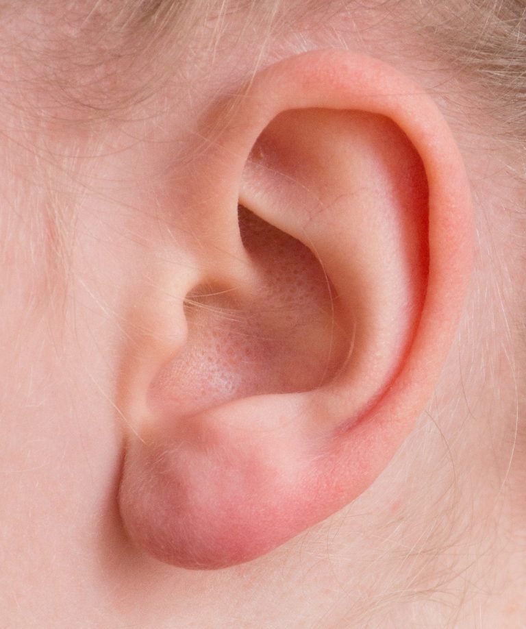 ¿Por qué algunos niños hacen otitis una y otra vez?