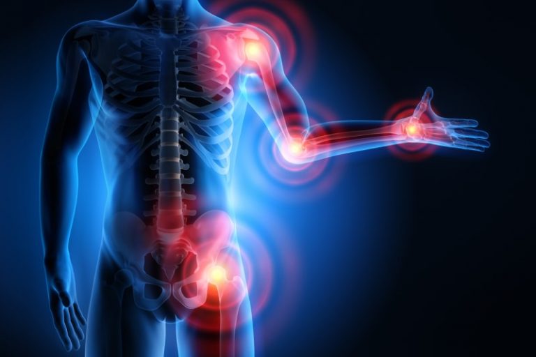 Ayuda para Artritis & Artrosis con fitoterapia China